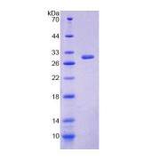 SDS-PAGE analysis of Human ALOX12B Protein.