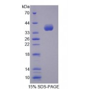 SDS-PAGE analysis of Mouse ALOX12B Protein.