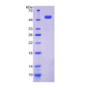 SDS-PAGE analysis of Human ACP6 Protein.