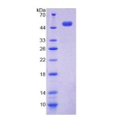 SDS-PAGE analysis of Human ACP6 Protein.