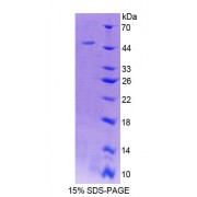 SDS-PAGE analysis of Rat ACP6 Protein.