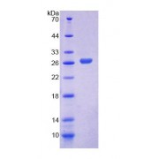SDS-PAGE analysis of recombinant Human LRP1B Protein.