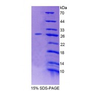 SDS-PAGE analysis of recombinant Mouse LRP1B Protein.