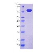 SDS-PAGE analysis of Mouse LXRb Protein.