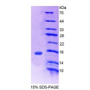 SDS-PAGE analysis of Human CHRNb3 Protein.