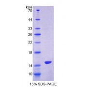 SDS-PAGE analysis of Human S100Z Protein.