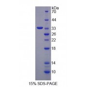 SDS-PAGE analysis of recombinant Human GaNAB Protein.