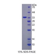 SDS-PAGE analysis of recombinant Human GaNAB Protein.