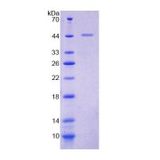 SDS-PAGE analysis of Human AGL Protein.