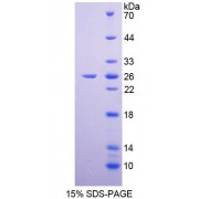 SDS-PAGE analysis of Human CCNB Protein.