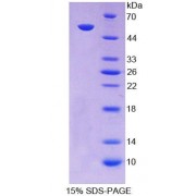 SDS-PAGE analysis of Human SCNN1a Protein.