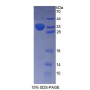 SDS-PAGE analysis of recombinant Human Proenkephalin A Protein.