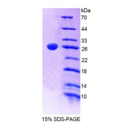 SDS-PAGE analysis of Human MYH11 Protein.