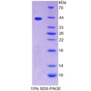 SDS-PAGE analysis of Human TPM2 Protein.