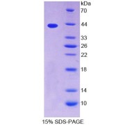 SDS-PAGE analysis of recombinant Human Tropomyosin 2 Beta (TPM2) Protein.