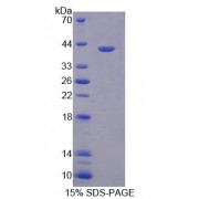 SDS-PAGE analysis of Human HSP90aB1 Protein.