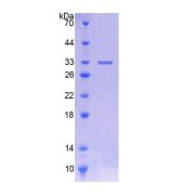 SDS-PAGE analysis of Pig CYP11A1 Protein.