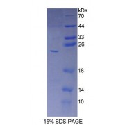 SDS-PAGE analysis of Human CYP5A1 Protein.