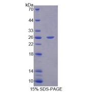 SDS-PAGE analysis of recombinant Human PTPN21 Protein.