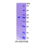 SDS-PAGE analysis of recombinant Mouse PTPN21 Protein.