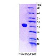 SDS-PAGE analysis of Human PTPRE Protein.