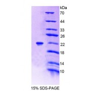 SDS-PAGE analysis of recombinant Human PTPRZ Protein.