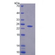 SDS-PAGE analysis of Human PTPRN2 Protein.