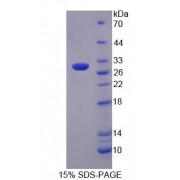 SDS-PAGE analysis of Mouse PTPRN2 Protein.