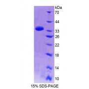 SDS-PAGE analysis of Human PPFIA1 Protein.
