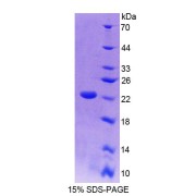 SDS-PAGE analysis of Human PTP4A2 Protein.