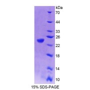 SDS-PAGE analysis of Human PTP4A1 Protein.