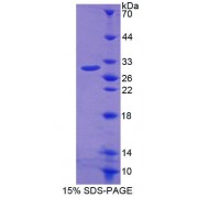 SDS-PAGE analysis of Mouse ABCA2 Protein.