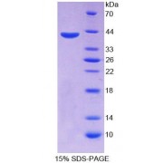 SDS-PAGE analysis of recombinant Human ABCA4 Protein.