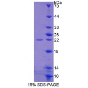 SDS-PAGE analysis of Human ABCE1 Protein.