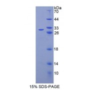 SDS-PAGE analysis of Mouse ABCC6 Protein.