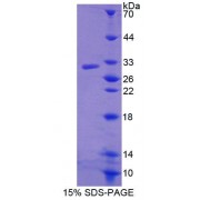 SDS-PAGE analysis of Human ABCC11 Protein.