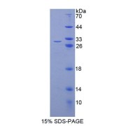 abx650378