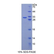 SDS-PAGE analysis of recombinant Human ABCB6 Protein.