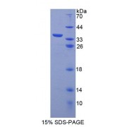 SDS-PAGE analysis of Human ABCB7 Protein.