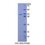 SDS-PAGE analysis of Mouse ABCB8 Protein.