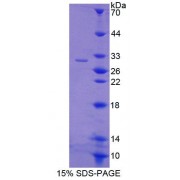 SDS-PAGE analysis of Rat ABCB8 Protein.