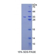 SDS-PAGE analysis of Human ABCB9 Protein.