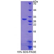 SDS-PAGE analysis of Human ABCF1 Protein.