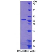 SDS-PAGE analysis of Mouse ABCA6 Protein.