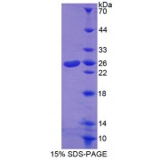 SDS-PAGE analysis of Human ABCA8 Protein.
