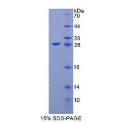 SDS-PAGE analysis of Mouse ABCA8 Protein.