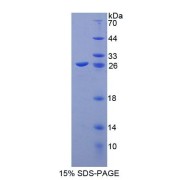 SDS-PAGE analysis of Mouse ABCA8 Protein.