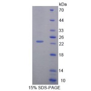 abx650399