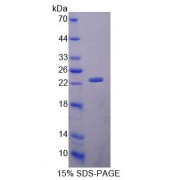 SDS-PAGE analysis of Rat ABCA9 Protein.