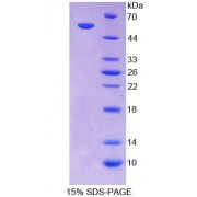 SDS-PAGE analysis of recombinant Mouse ABCA13 Protein.